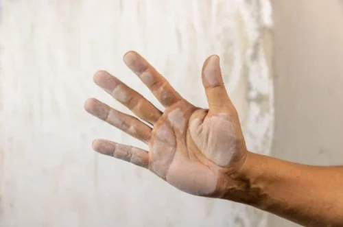 Estimasi Biaya Renovasi Dinding Rumah 5 Biaya Renovasi Dinding Rumah